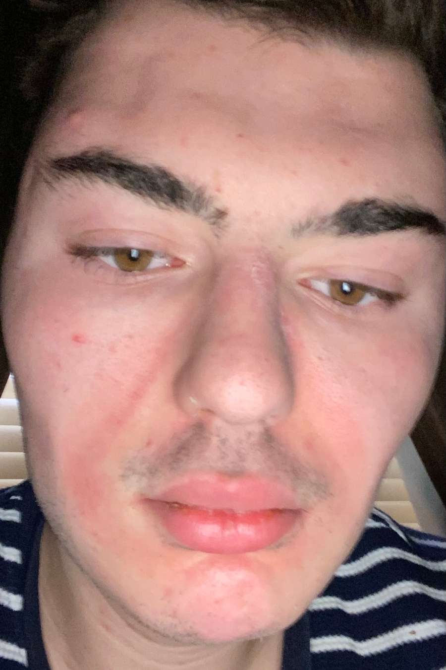 87658290 2456 medium large