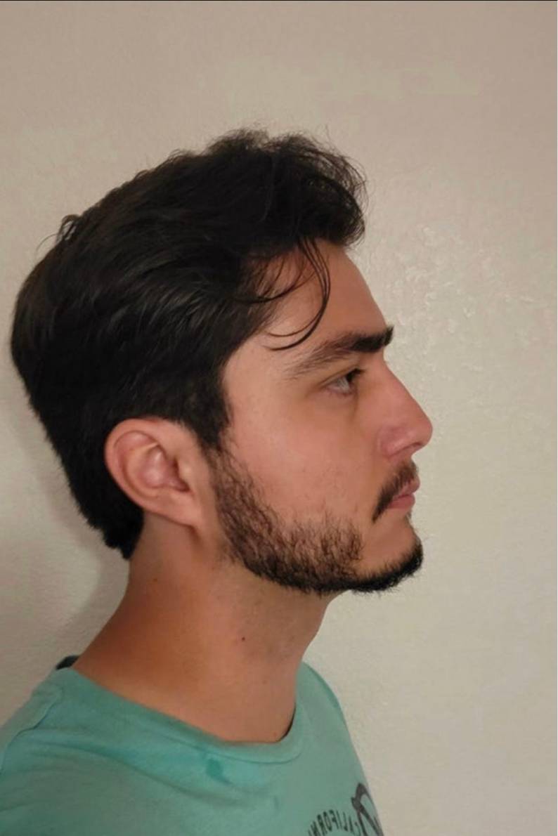 90698817 7822 medium large