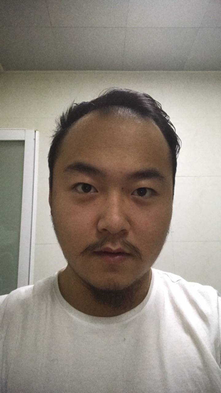 88089209 817 medium large
