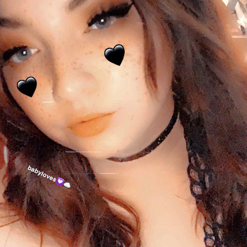 44156645 9011