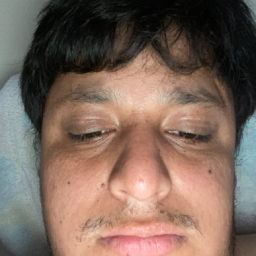 55734739 377