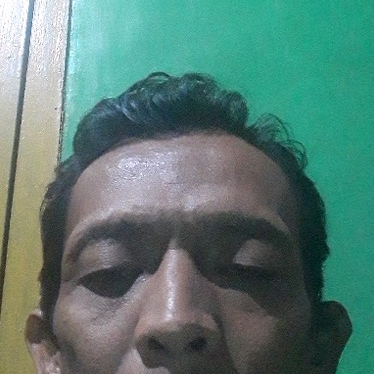 62725181 2395
