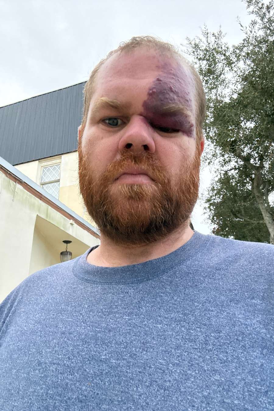 90285258 9560 medium large