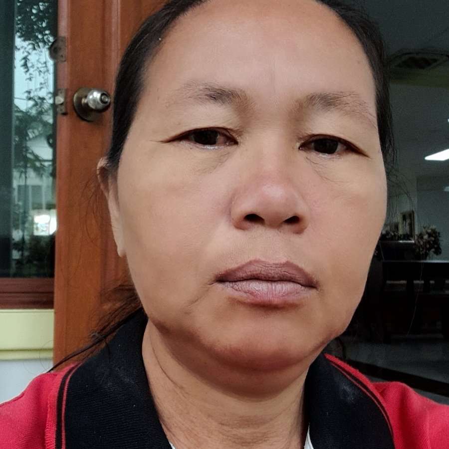 77325389 8831 medium large